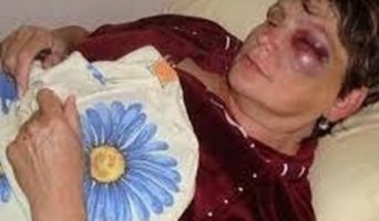 Ударил женщину в живот
